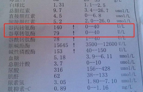 谷丙轉(zhuǎn)氨酶.jpg
