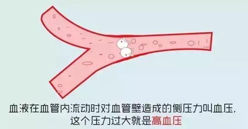 高血壓.jpg